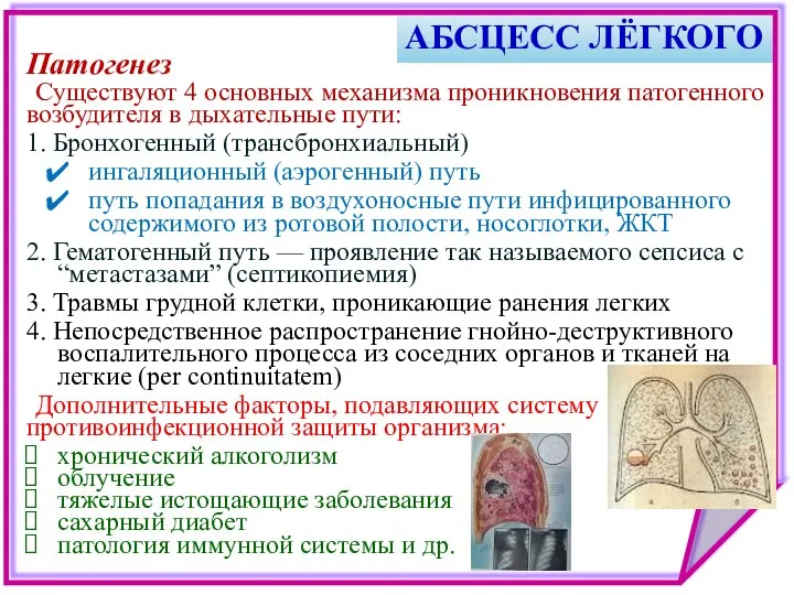 АБСЦЕСС ЛЁГКОГО Патогенез Существуют 4 основных механизма проникновения патогенного возбудителя в