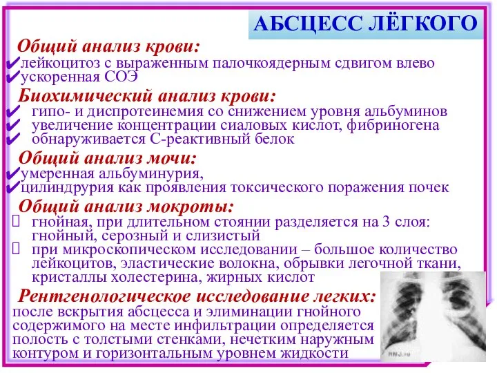 АБСЦЕСС ЛЁГКОГО лейкоцитоз с выраженным палочкоядерным сдвигом влево ускоренная СОЭ Биохимический