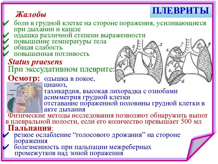 ПЛЕВРИТЫ боли в грудной клетке на стороне поражения, усиливающиеся при дыхании