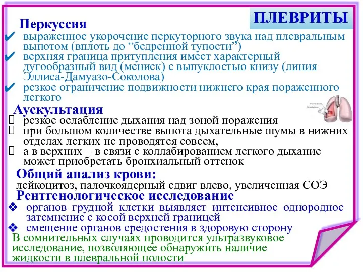 ПЛЕВРИТЫ выраженное укорочение перкуторного звука над плевральным выпотом (вплоть до “бедренной