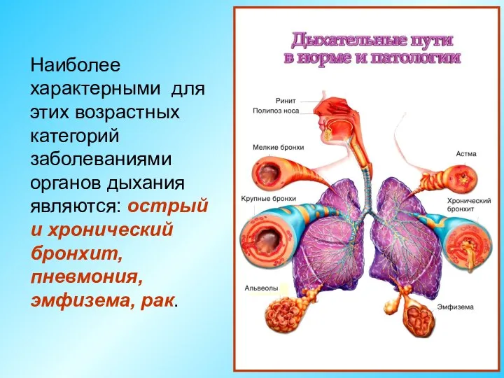 Наиболее характерными для этих возрастных категорий заболеваниями органов дыхания являются: острый