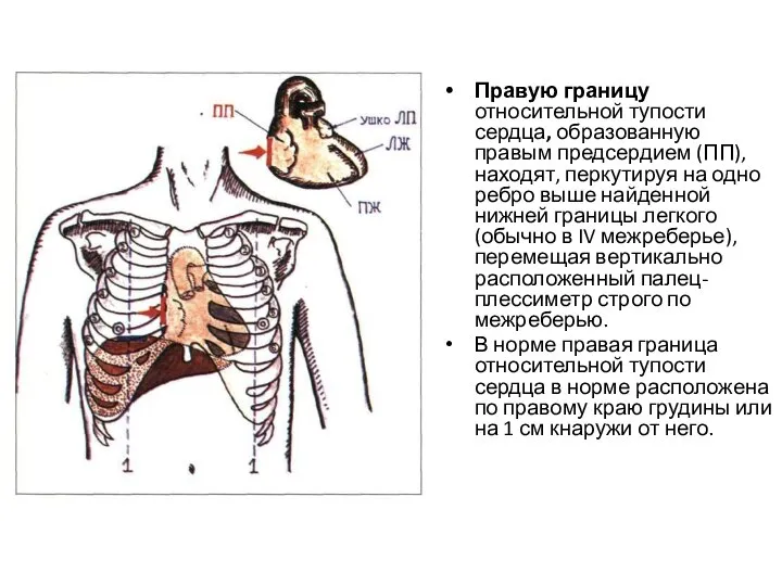 Правую границу относительной тупости сердца, образованную правым предсердием (ПП), находят, перкутируя