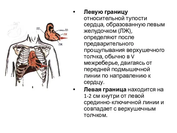 Левую границу относительной тупости сердца, образованную левым желудочком (ЛЖ), определяют после