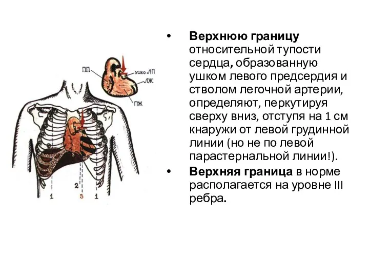 Верхнюю границу относительной тупости сердца, образованную ушком левого предсердия и стволом