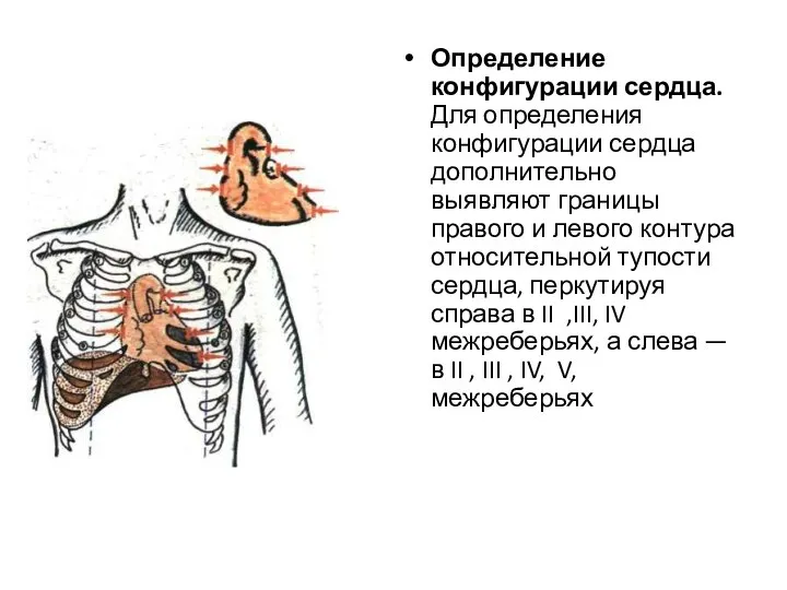 Определение конфигурации сердца. Для определения конфигурации сердца дополнительно выявляют границы правого