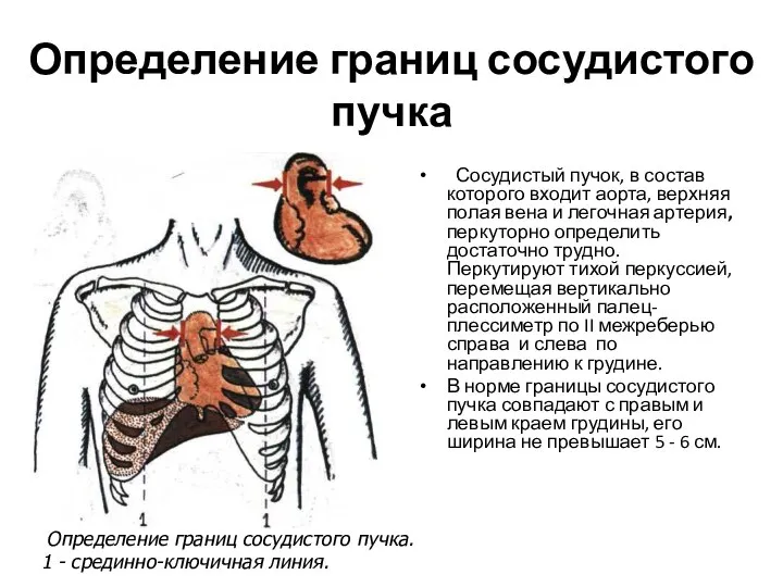 Определение границ сосудистого пучка Сосудистый пучок, в состав которого входит аорта,