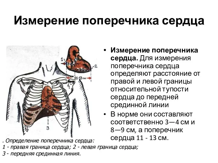 Измерение поперечника сердца Измерение поперечника сердца. Для измерения поперечника сердца определяют