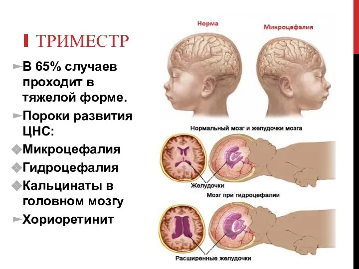 I ТРИМЕСТР В 65% случаев проходит в тяжелой форме. Пороки развития