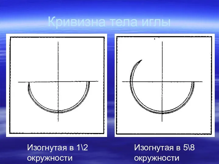 Кривизна тела иглы Изогнутая в 1\2 окружности Изогнутая в 5\8 окружности