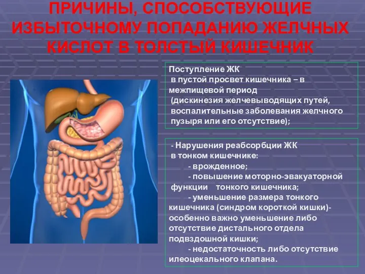 ПРИЧИНЫ, СПОСОБСТВУЮЩИЕ ИЗБЫТОЧНОМУ ПОПАДАНИЮ ЖЕЛЧНЫХ КИСЛОТ В ТОЛСТЫЙ КИШЕЧНИК Поступление ЖК