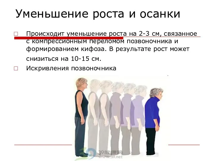 Уменьшение роста и осанки Происходит уменьшение роста на 2-3 см, связанное