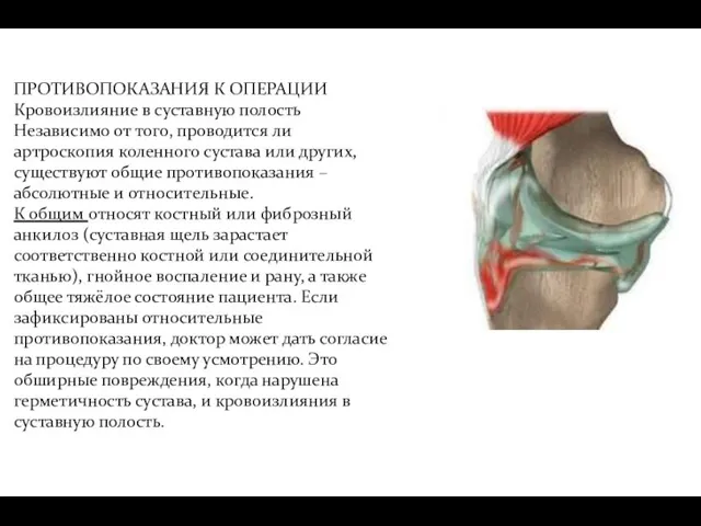 ПРОТИВОПОКАЗАНИЯ К ОПЕРАЦИИ Кровоизлияние в суставную полость Независимо от того, проводится