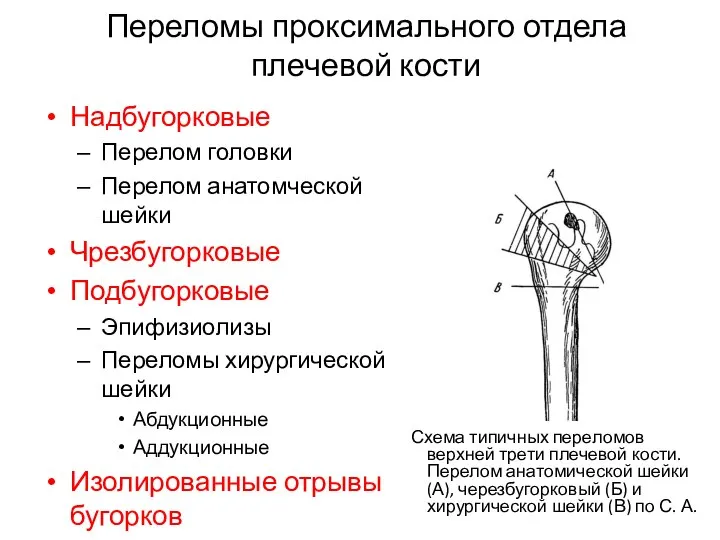 Переломы проксимального отдела плечевой кости Надбугорковые Перелом головки Перелом анатомческой шейки