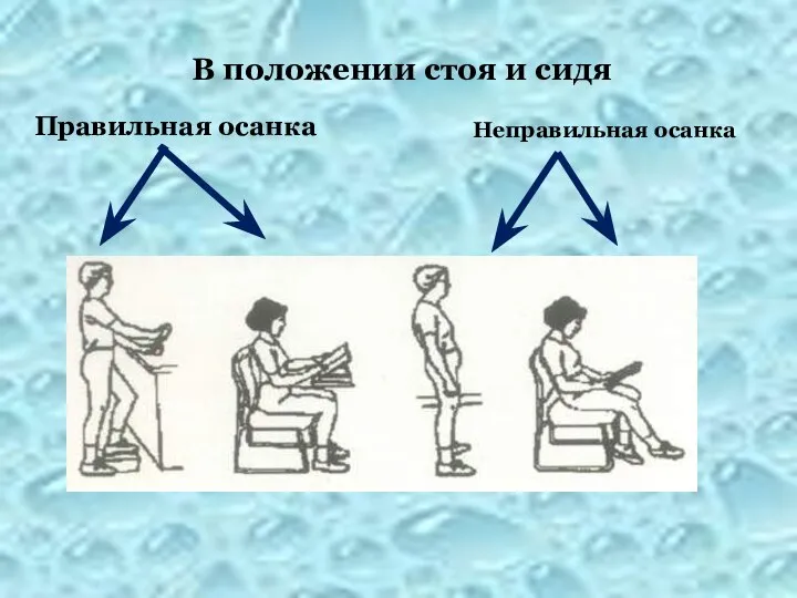 Неправильная осанка Правильная осанка В положении стоя и сидя