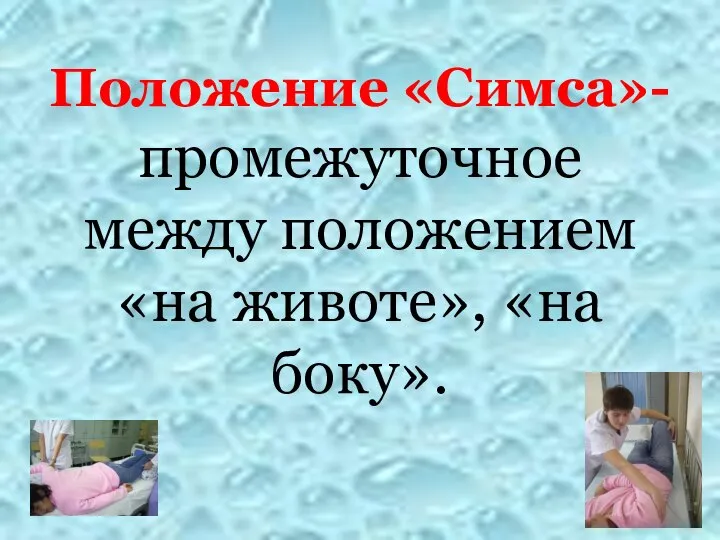 Положение «Симса»- промежуточное между положением «на животе», «на боку».