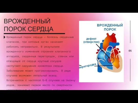 Врожденный порок сердца - болезнь сердечных клапанов, при которых орган начинает