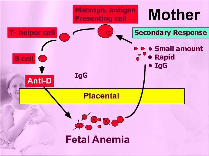 Anti-D Macroph. antigen Presenting cell T- helper cell B cell Fetal