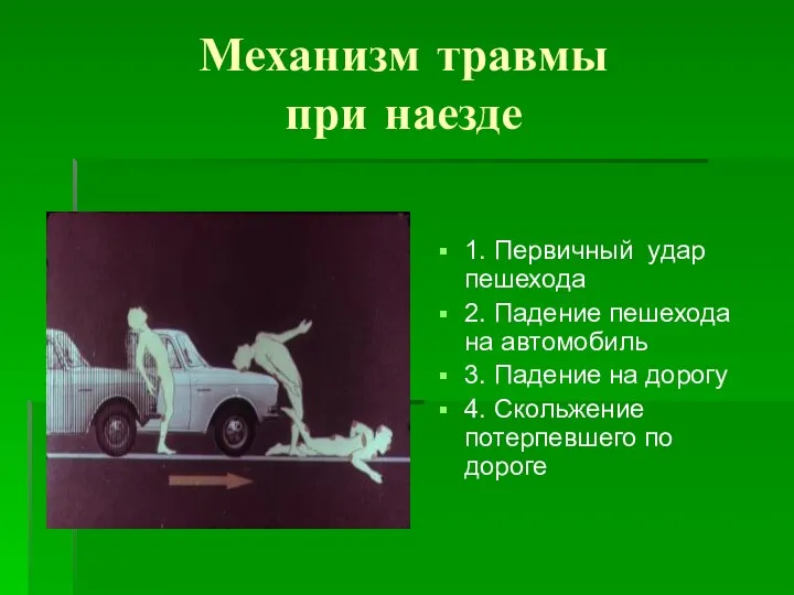 Механизм травмы при наезде 1. Первичный удар пешехода 2. Падение пешехода