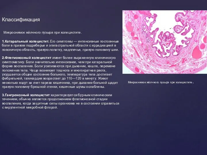 Классификация Микроснимок жёлчного пузыря при холецистите. 1.Катаральный холецистит. Его симптомы —