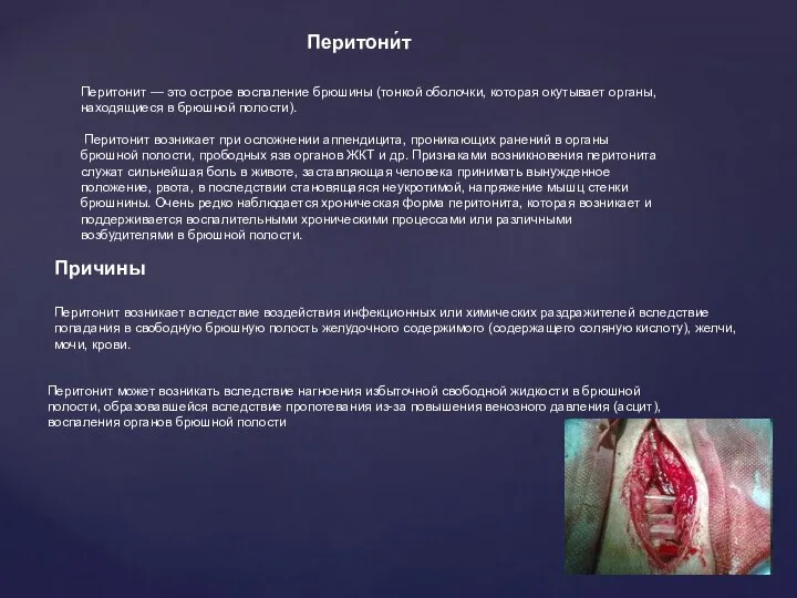 Перитонит может возникать вследствие нагноения избыточной свободной жидкости в брюшной полости,