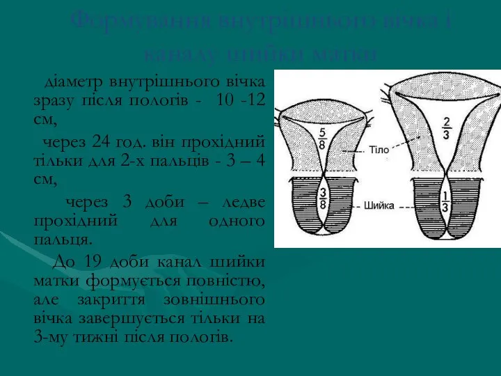 Формування внутрішнього вічка і каналу шийки матки діаметр внутрішнього вічка зразу