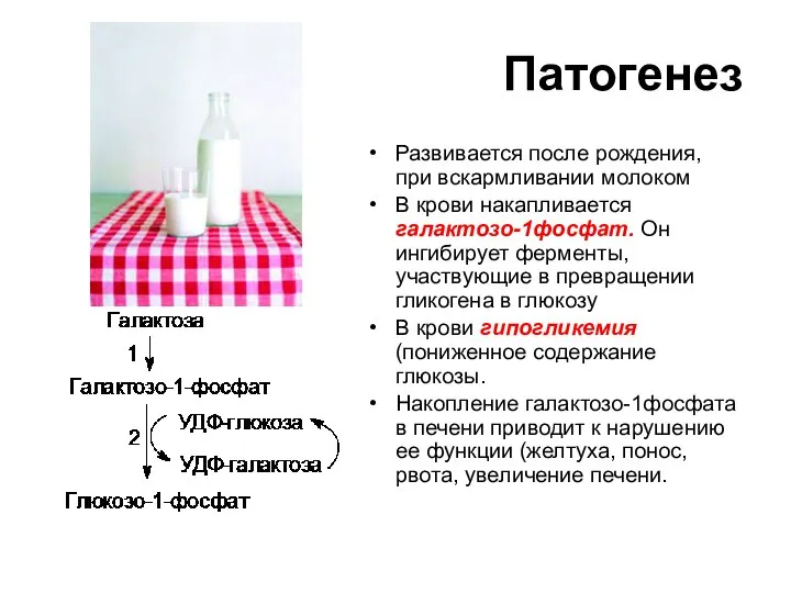 Патогенез Развивается после рождения, при вскармливании молоком В крови накапливается галактозо-1фосфат.