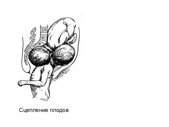 Сцепление плодов