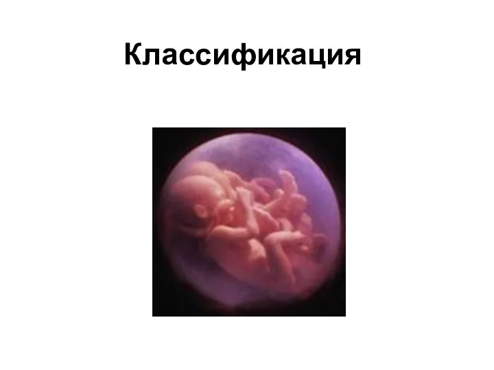 Классификация