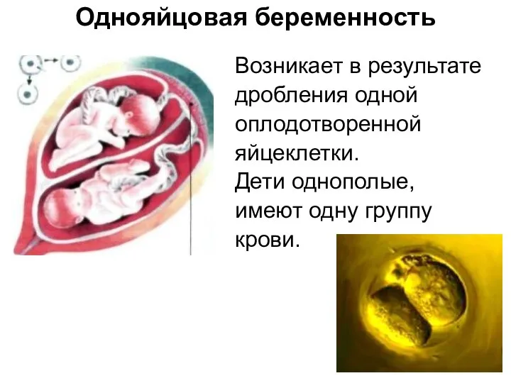 Однояйцовая беременность Возникает в результате дробления одной оплодотворенной яйцеклетки. Дети однополые, имеют одну группу крови.