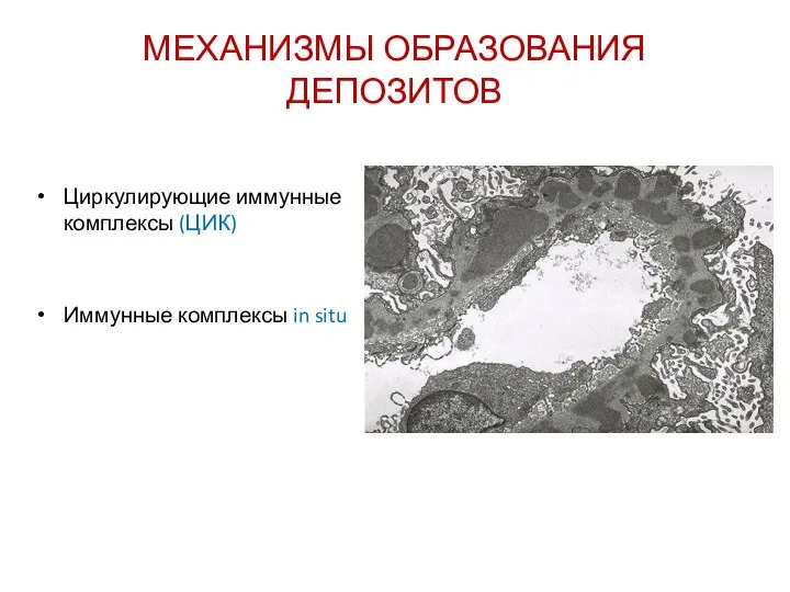 МЕХАНИЗМЫ ОБРАЗОВАНИЯ ДЕПОЗИТОВ Циркулирующие иммунные комплексы (ЦИК) Иммунные комплексы in situ