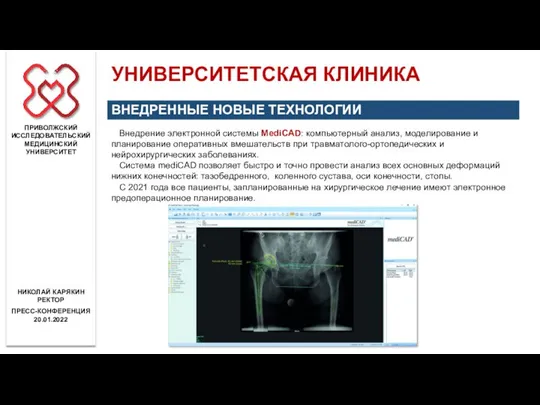 Внедрение электронной системы MediCAD: компьютерный анализ, моделирование и планирование оперативных вмешательств