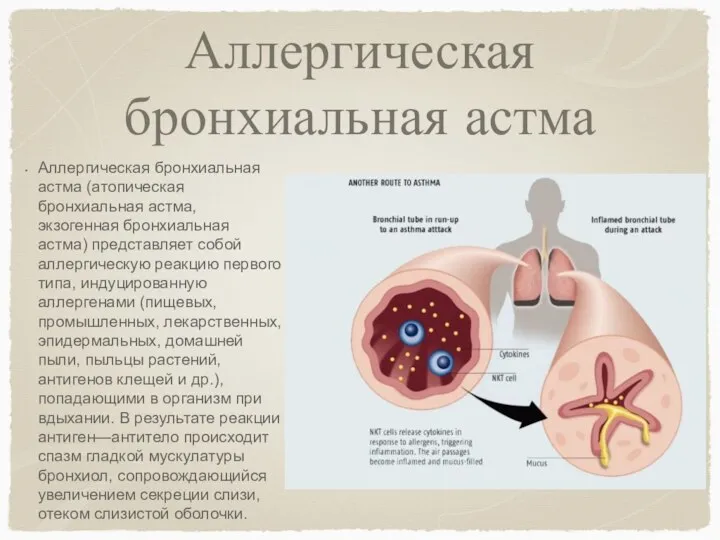 Аллергическая бронхиальная астма Аллергическая бронхиальная астма (атопическая бронхиальная астма, экзогенная бронхиальная