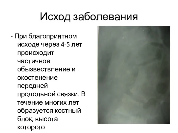 Исход заболевания - При благоприятном исходе через 4-5 лет происходит частичное