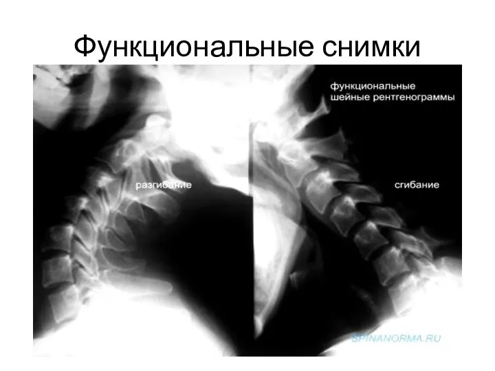 Функциональные снимки