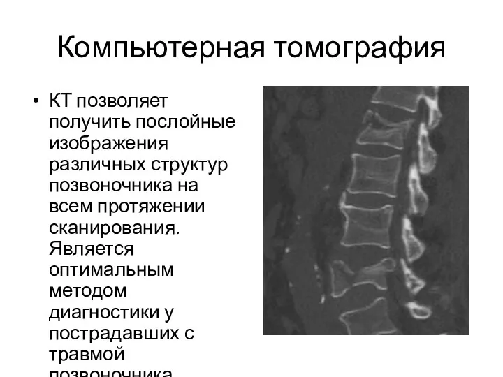 Компьютерная томография КТ позволяет получить послойные изображения различных структур позвоночника на