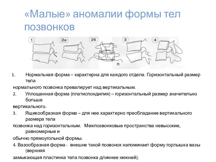 «Малые» аномалии формы тел позвонков Нормальная форма – характерна для каждого