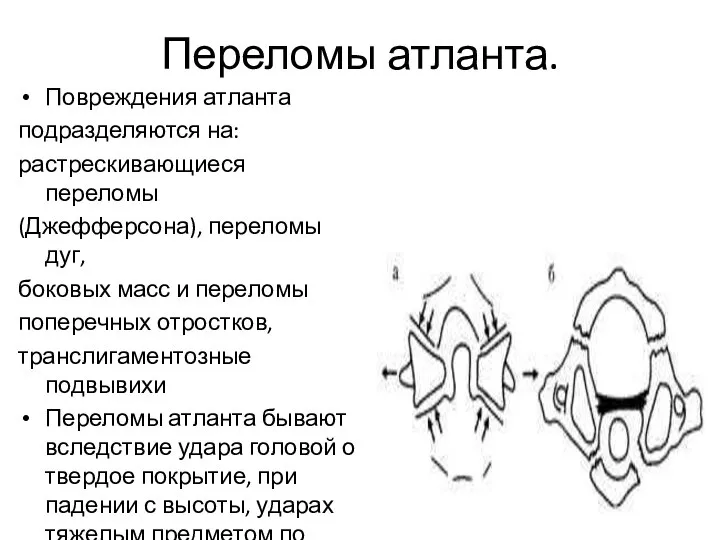 Переломы атланта. Повреждения атланта подразделяются на: растрескивающиеся переломы (Джефферсона), переломы дуг,