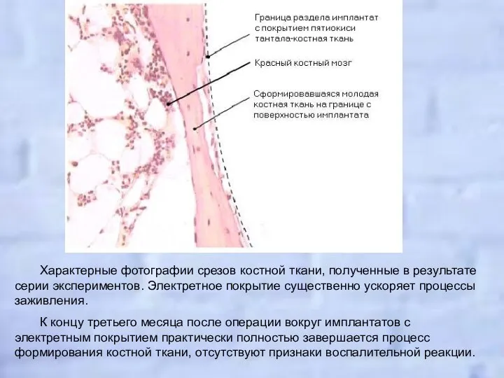 Характерные фотографии срезов костной ткани, полученные в результате серии экспериментов. Электретное