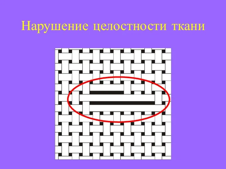 Нарушение целостности ткани