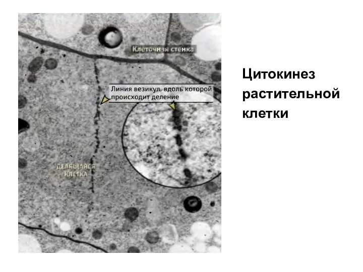 Цитокинез растительной клетки