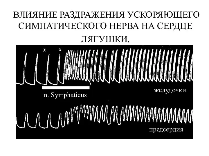 ВЛИЯНИЕ РАЗДРАЖЕНИЯ УСКОРЯЮЩЕГО СИМПАТИЧЕСКОГО НЕРВА НА СЕРДЦЕ ЛЯГУШКИ. n. Symphaticus желудочки предсердия