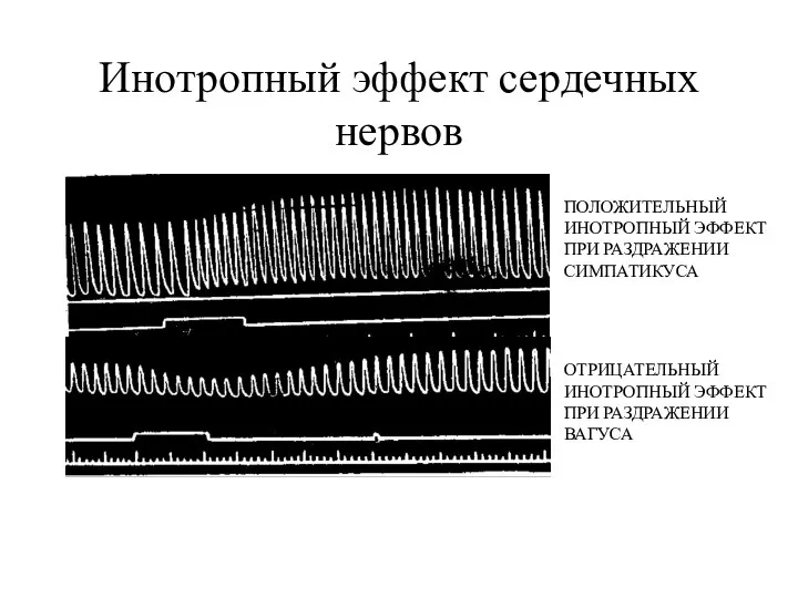 Инотропный эффект сердечных нервов ПОЛОЖИТЕЛЬНЫЙ ИНОТРОПНЫЙ ЭФФЕКТ ПРИ РАЗДРАЖЕНИИ СИМПАТИКУСА ОТРИЦАТЕЛЬНЫЙ ИНОТРОПНЫЙ ЭФФЕКТ ПРИ РАЗДРАЖЕНИИ ВАГУСА