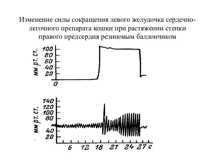 Изменение силы сокращения левого желудочка сердечно-легочного препарата кошки при растяжении стенки правого предсердия резиновым баллончиком