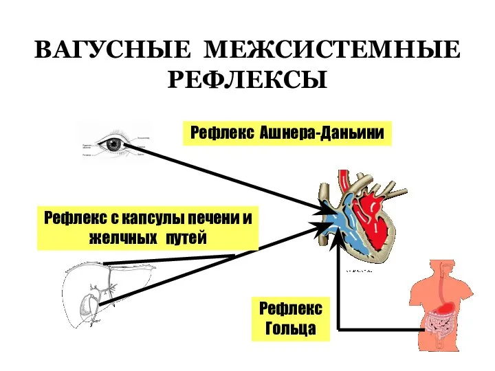 ВАГУСНЫЕ МЕЖСИСТЕМНЫЕ РЕФЛЕКСЫ Рефлекс Ашнера-Даньини Рефлекс с капсулы печени и желчных путей Рефлекс Гольца