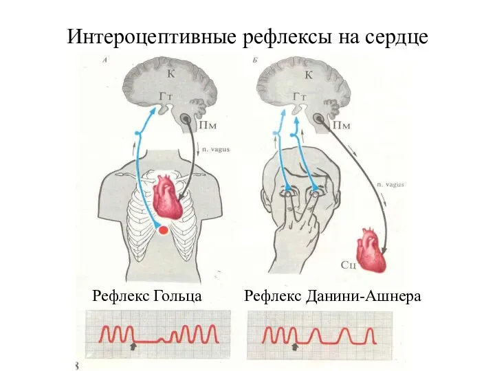 Интероцептивные рефлексы на сердце Рефлекс Гольца Рефлекс Данини-Ашнера