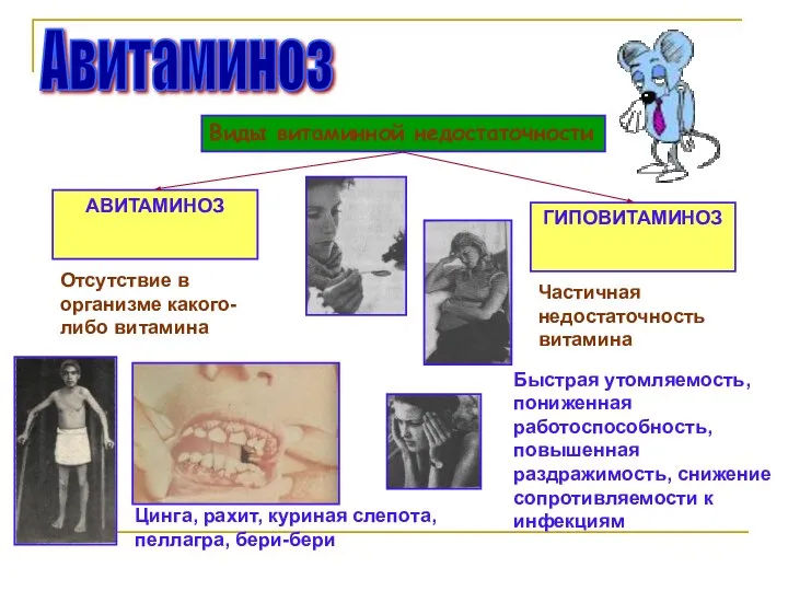 Авитаминоз Виды витаминной недостаточности АВИТАМИНОЗ ГИПОВИТАМИНОЗ Отсутствие в организме какого-либо витамина