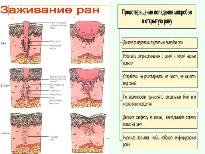 Заживание ран