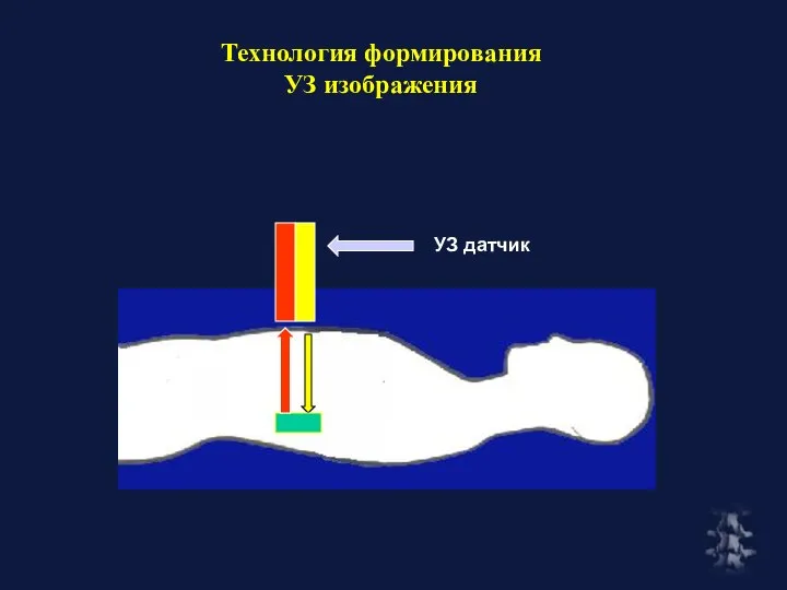 Технология формирования УЗ изображения