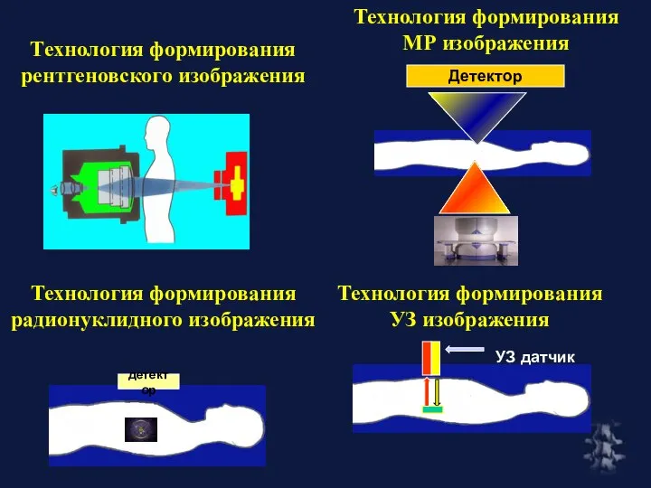 Технология формирования радионуклидного изображения Технология формирования рентгеновского изображения Технология формирования МР изображения Технология формирования УЗ изображения