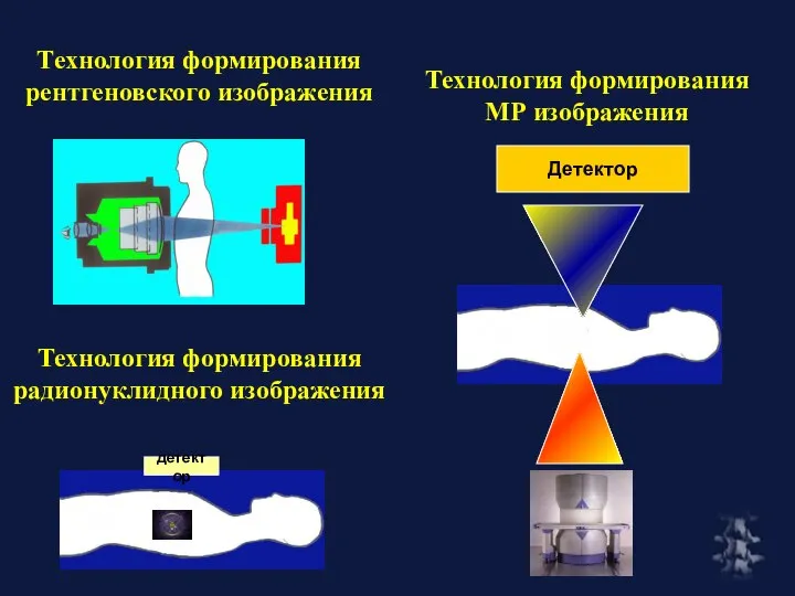 Технология формирования радионуклидного изображения Технология формирования рентгеновского изображения Технология формирования МР изображения Детектор